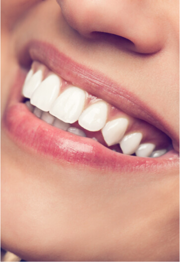 Image showing smiling teeth of a woman