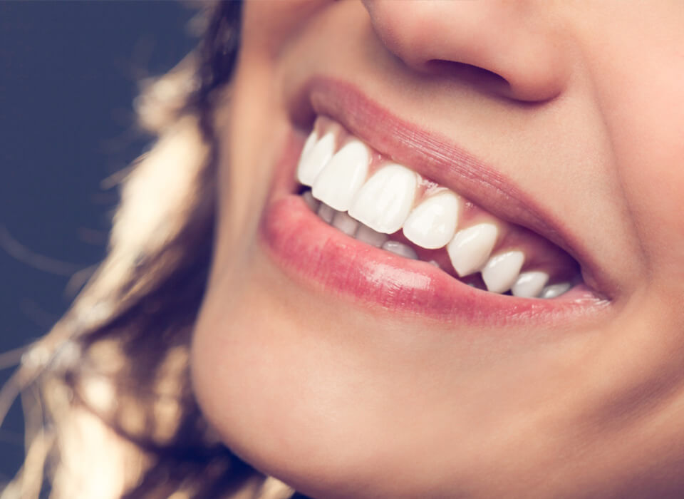 Image showing smiling teeth of a woman