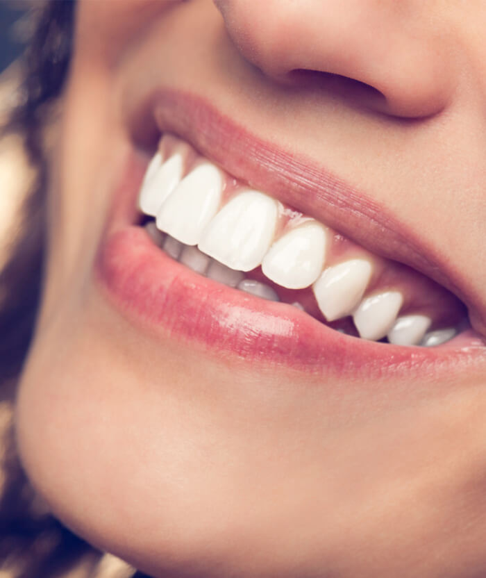 Image showing smiling teeth of a woman