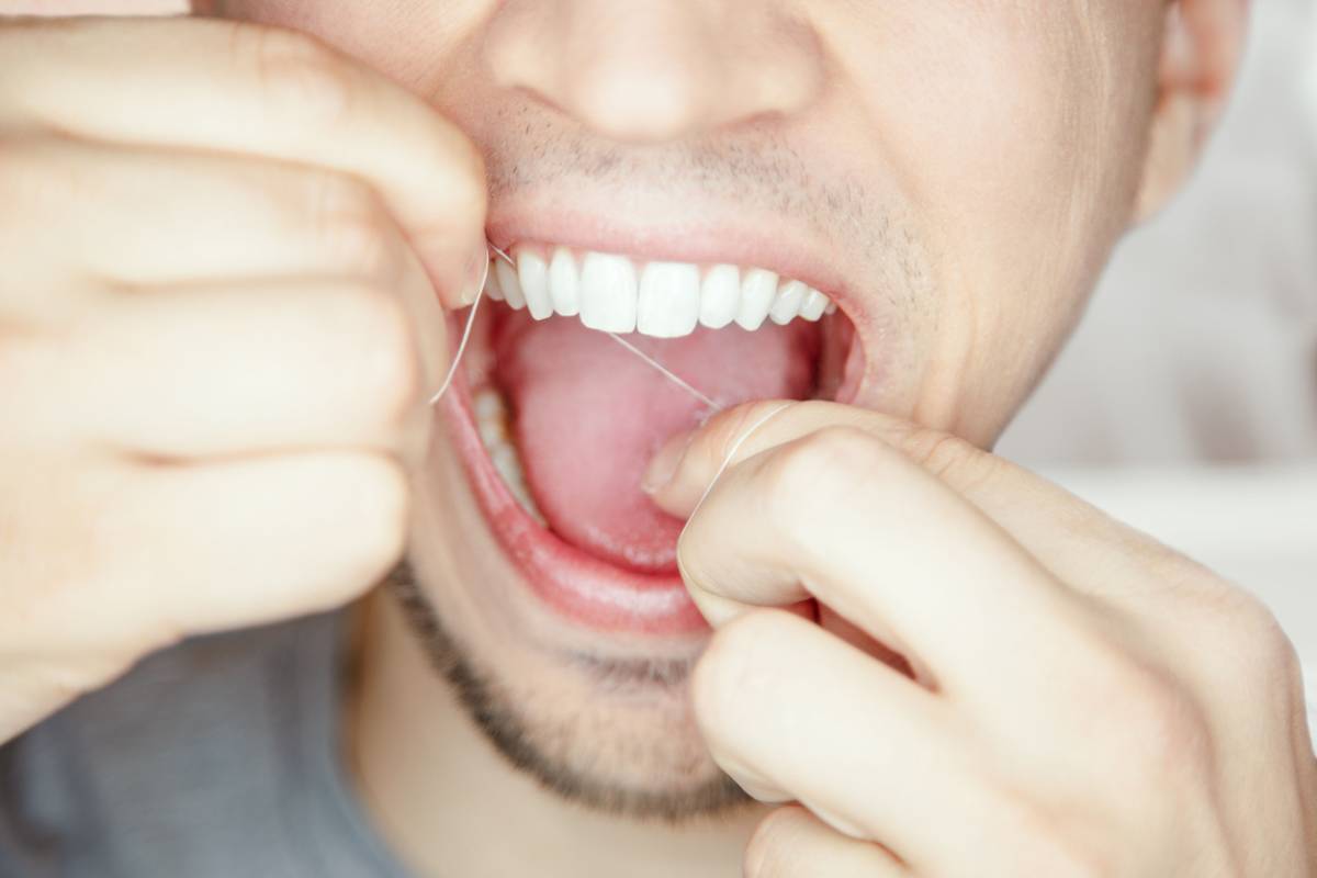 featured image for question can you floss with veneers